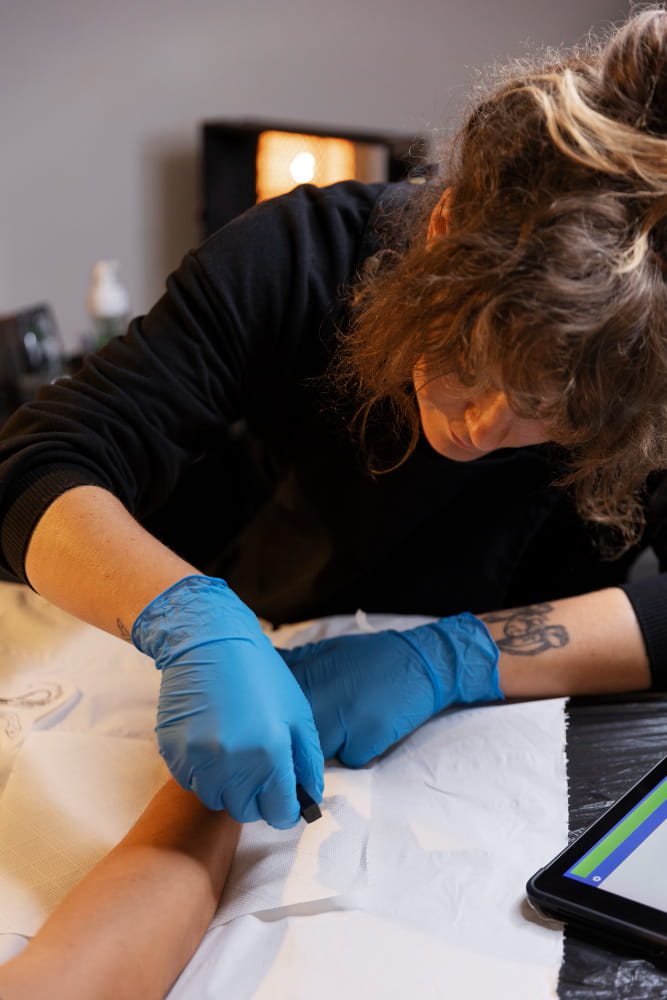 usuwanie tatuażu