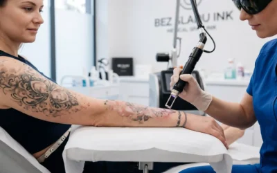 Laserowe usuwanie tatuażu – kiedy widać pierwsze efekty?